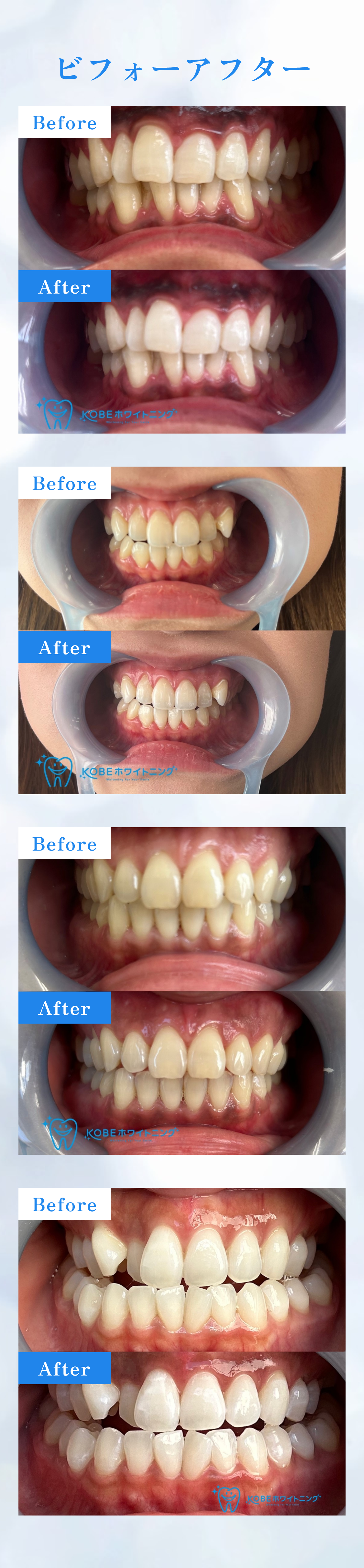 before/after